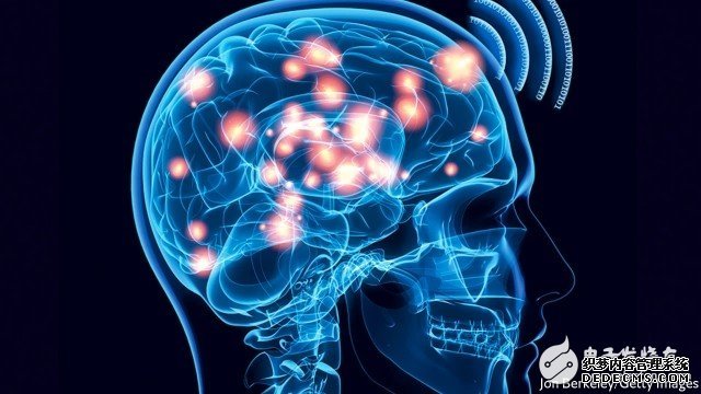 经济学人封面文章：脑机界面或将改变“人类”定义